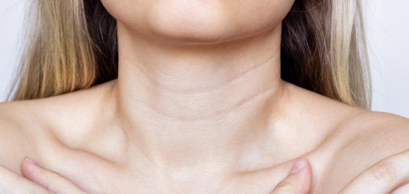 Botulinum Toxin Type A and neck